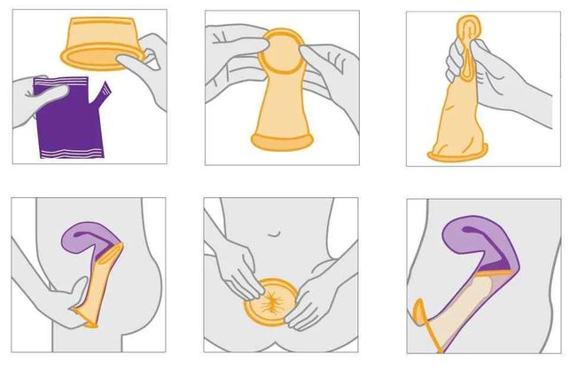 How do men wear condoms? What accidents are prone to occur during sexual activity?